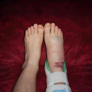 Ankle Support (Pair) — Model 004 — ShopOfBD Bangladesh