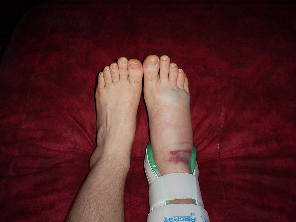 Ankle Support (Pair) — Model 004 — ShopOfBD Bangladesh