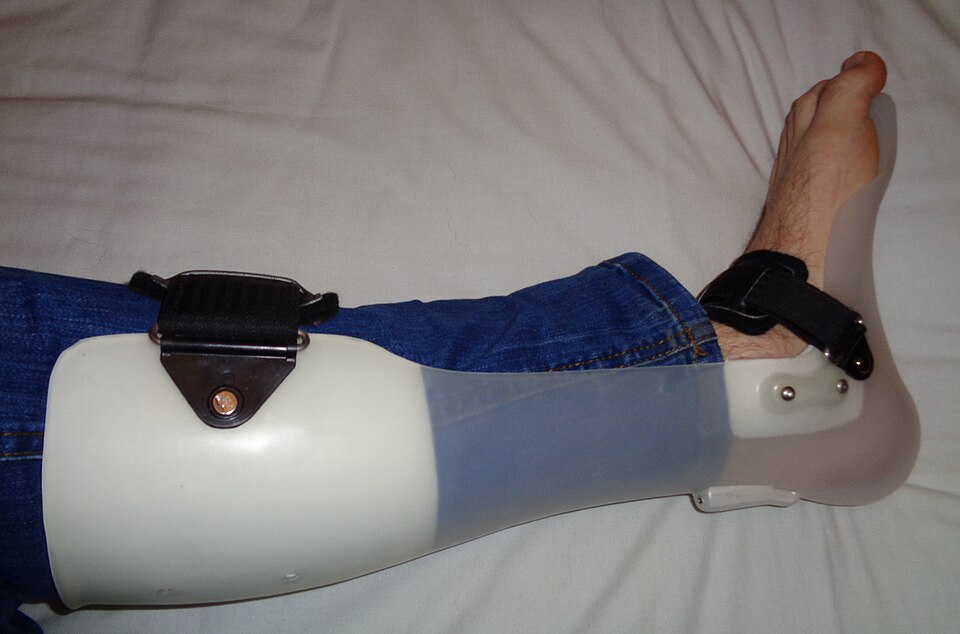 Ankle Support (Pair) — Model 005 — ShopOfBD Bangladesh